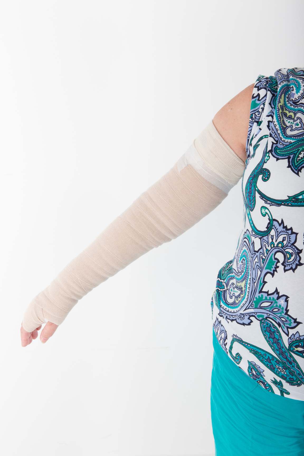 mature woman with lymphedema
